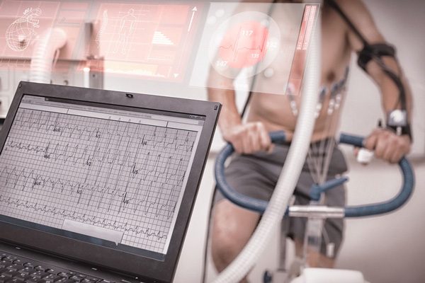 Cardiopulmonary-Exercise-Testing